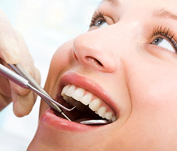 Phoenix AZ smiles cosmetic dental procedures