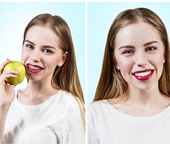 A cosmetic dentist keeps Glendale AZ smiling