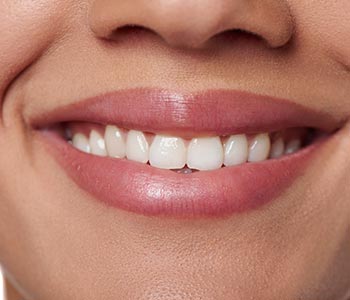 Get a life enhancement with cosmetic dentistry in Phoenix