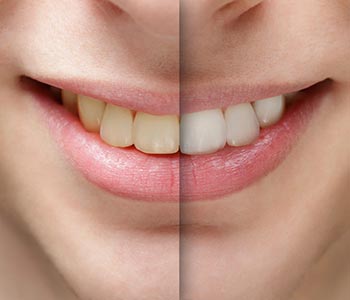 What your cosmetic dentist in Scottsdale can do for you
