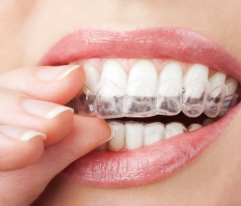 Phoenix is ready to smile again with home teeth whitening