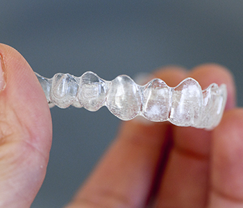 Invisalign Braces Price Phoenix