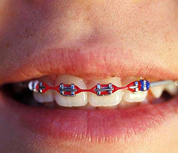 Orthodontics Phoenix