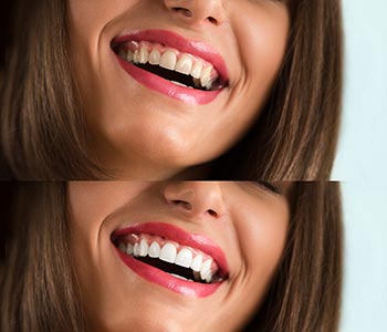 How can cosmetic dentistry change my life?