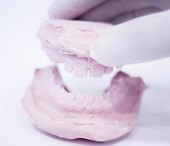 Do Veneers Cause Any Risk to a Tooth’s Structure?