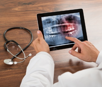 Root canals 101: Understanding injury, infection, and treatment in Phoenix, AZ