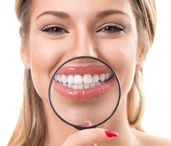 smile makeover by Dr Koppikar