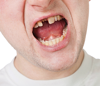 Dentist in Phoenix gives patients new teeth in one day