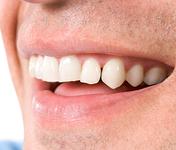 Dentist near Glendale is successfully using CEREC technology for same day dental crowns