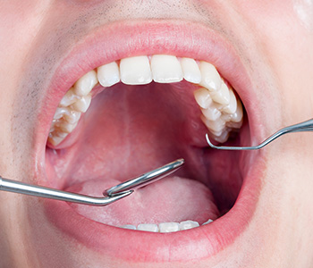 Advanced and effective oral cancer screening in Arizona