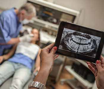 Myths about treatment for root canals in Phoenix