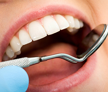 Phoenix treatment for gum disease may include root planing and scaling