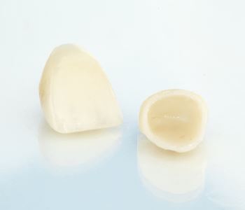 Phoenix, AZ dentist offers ceramic dental crowns