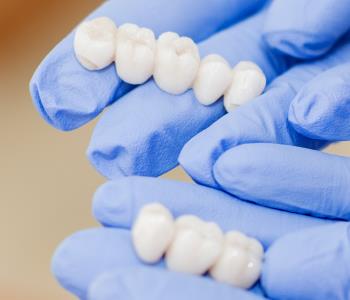 Phoenix, AZ area dentist offers crowns for teeth