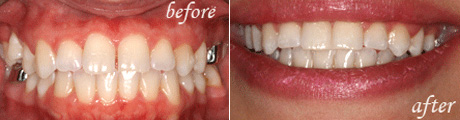 After Cosmetic Treatment