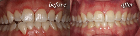 Sedation Before After Image
