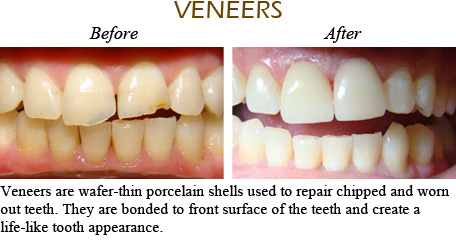 Smile Gallery Mississauga - Before After Image 1