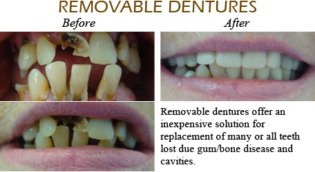 Smile Gallery Mississauga - Before After Image 10