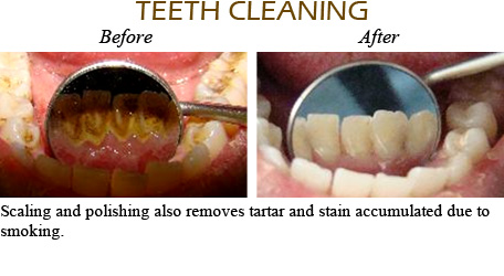 Smile Gallery Mississauga - Before After Image 12