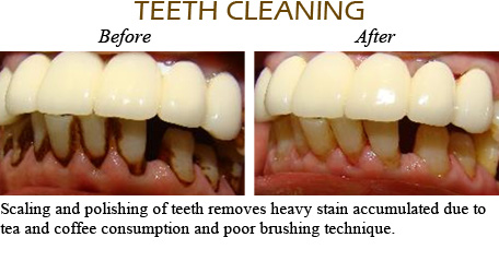 Smile Gallery Mississauga - Before After Image 13