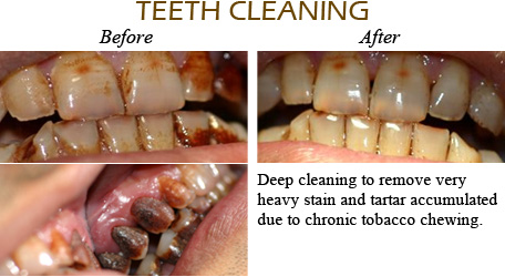 Smile Gallery Mississauga - Before After Image 14