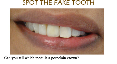Smile Gallery Mississauga - Before After Image 15