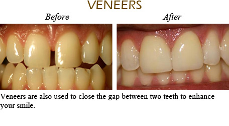 Smile Gallery Mississauga - Before After Image 2