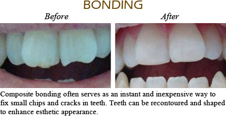 Smile Gallery Mississauga - Before After Image 3