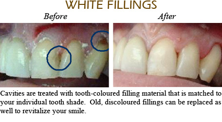 Smile Gallery Mississauga - Before After Image 4