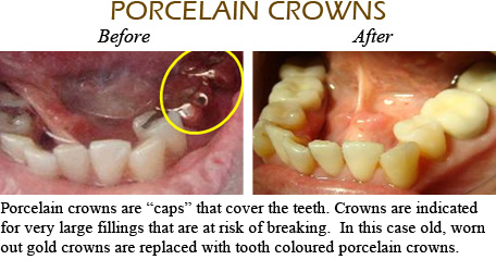 Smile Gallery Mississauga - Before After Image 5