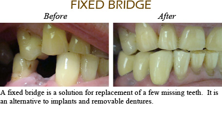 Smile Gallery Mississauga - Before After Image 6