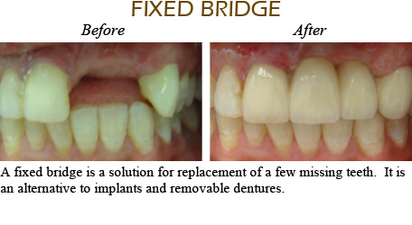Smile Gallery Mississauga - Before After Image 7