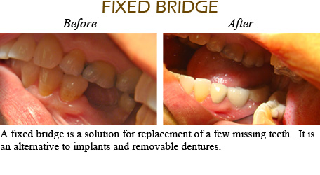 Smile Gallery Mississauga - Before After Image 8
