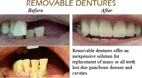 Smile Gallery Mississauga - Before After Image 9