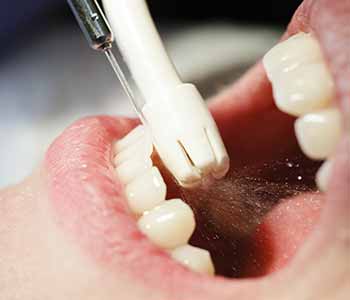 Dental hygiene in Daly City starts with a professional cleaning