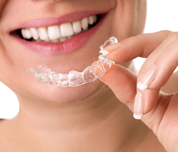 Clear Plastic Aligners San Francisco