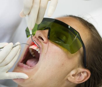 Amazing periodontitis treatment in San Francisco
