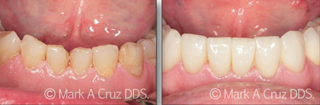 <?php echo $pk;?> - Cosmetic Dentistry 05