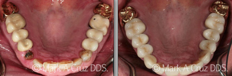 <?php echo $pk;?> - Cosmetic Dentistry 07