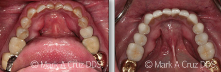 <?php echo $pk;?> - Cosmetic Dentistry 08