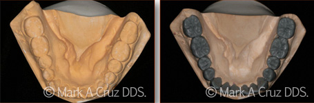 <?php echo $pk;?> - Cosmetic Dentistry 04