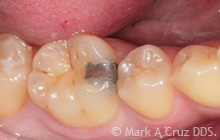 <?php echo $pk;?> - Cosmetic Dentistry 12