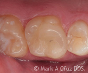<?php echo $pk;?> - Cosmetic Dentistry 10