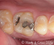 <?php echo $pk;?> - Cosmetic Dentistry 09