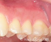 <?php echo $pk;?> - Cosmetic Dentistry 11