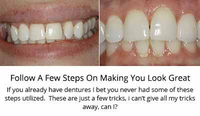 Full Dentures Procedure, Quincy