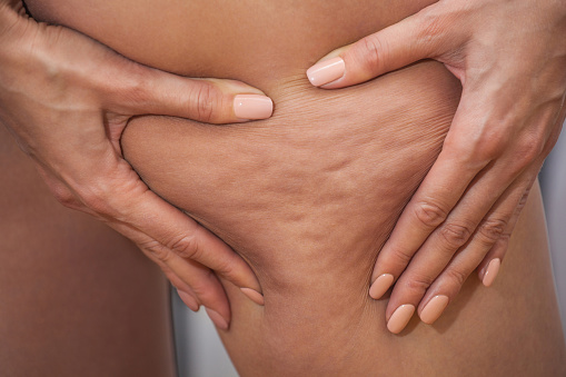 Dr Menkes Andrew at The Menkes Clinic & Surgery Center, Sclerotherapy