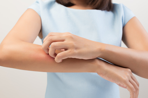 Dr Menkes Andrew at The Menkes Clinic & Surgery Center, Sclerotherapy
