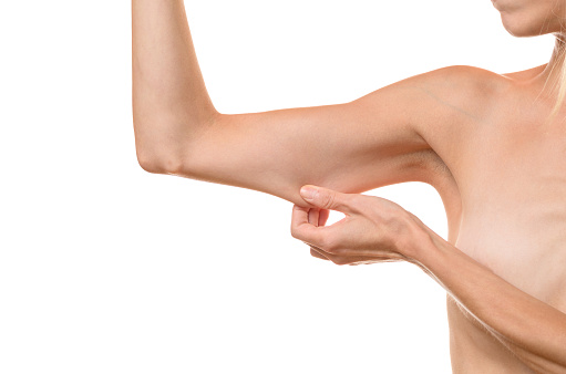 Dr Menkes Andrew at The Menkes Clinic & Surgery Center, Sclerotherapy