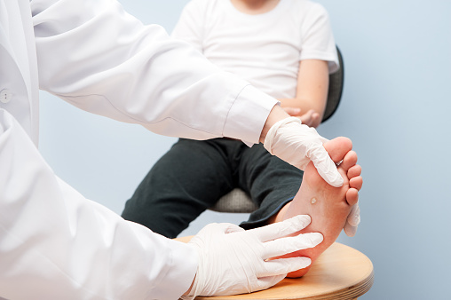 Dr Menkes Andrew at The Menkes Clinic & Surgery Center, Warts